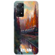 Redmi Note 11 Pro Silikon Kılıf Canvas Tren