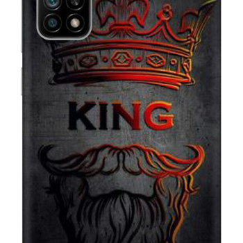Mi 10T / 10T Pro Kaplama King